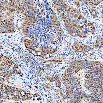 Anti-U1-C/SNRPC Antibody