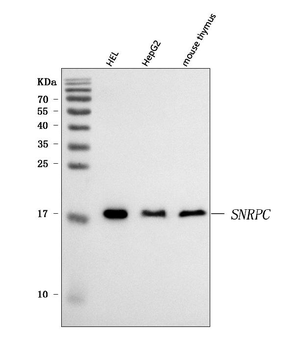 Anti-U1-C/SNRPC Antibody