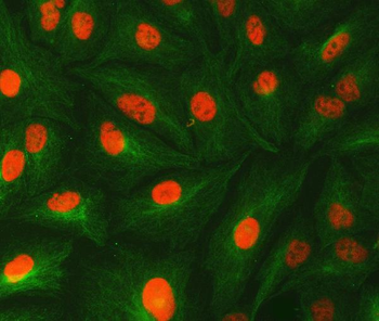 Anti-U1-C/SNRPC Antibody