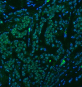 Anti-U1-C/SNRPC Antibody