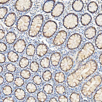 Anti-U1-C/SNRPC Antibody
