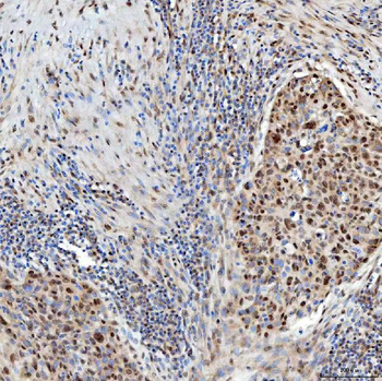 Anti-U1-C/SNRPC Antibody
