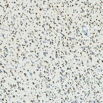 Anti-U1-C/SNRPC Antibody