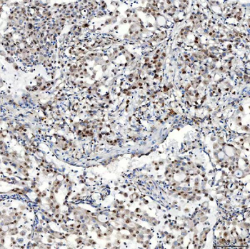 Anti-U1-C/SNRPC Antibody