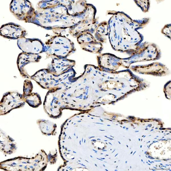 Anti-U1-C/SNRPC Antibody