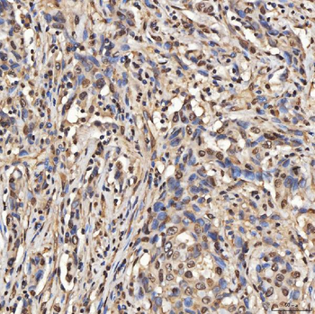 Anti-SNRPA1 Antibody