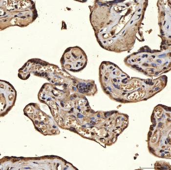 Anti-SNRPA1 Antibody