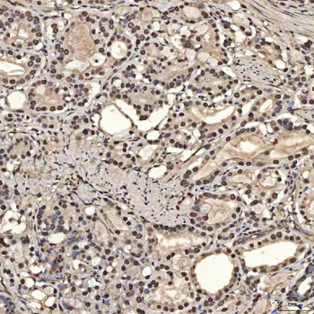 Anti-SNRPA1 Antibody