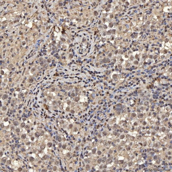 Anti-SNRPA1 Antibody