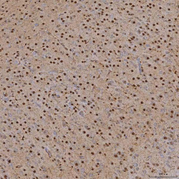 Anti-SNRPA1 Antibody