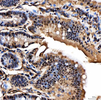 Anti-SNRPA1 Antibody