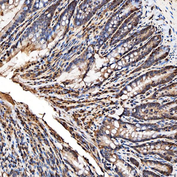 Anti-SNRPA1 Antibody