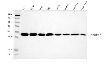 Anti-SNRPA1 Antibody