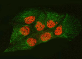 Anti-SNRPA1 Antibody