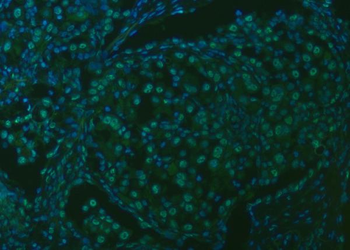 Anti-SNRPA1 Antibody