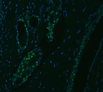 Anti-SNRPA1 Antibody