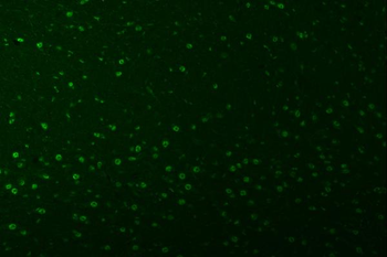 Anti-SNRPA1 Antibody