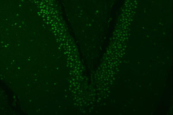 Anti-SNRPA1 Antibody
