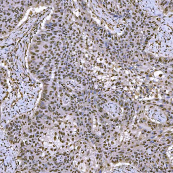 Anti-SNRPA1 Antibody