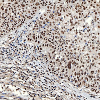 Anti-SNRNP40 Antibody