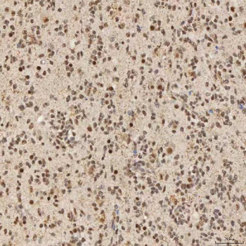 Anti-SNRNP40 Antibody