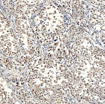 Anti-SNRNP40 Antibody