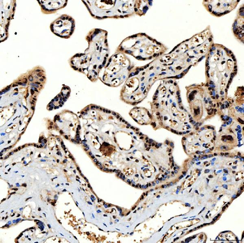 Anti-SNRNP40 Antibody