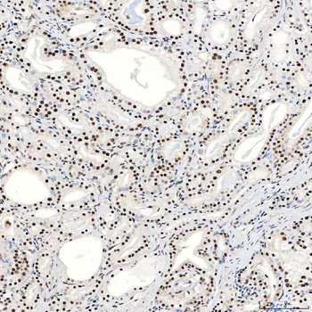 Anti-SNRNP40 Antibody