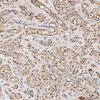 Anti-SNRNP40 Antibody