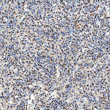 Anti-SNRNP40 Antibody