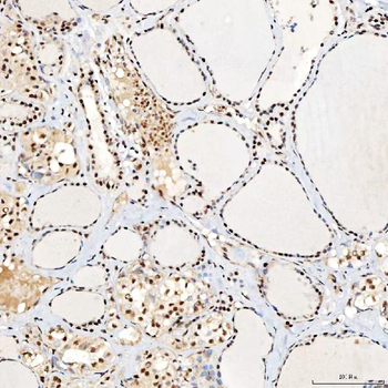 Anti-SNRNP40 Antibody