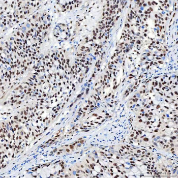 Anti-SNRNP40 Antibody