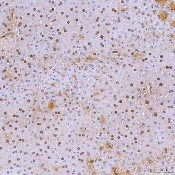 Anti-SNRNP40 Antibody