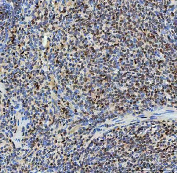 Anti-SNRNP40 Antibody