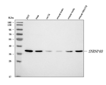 Anti-SNRNP40 Antibody