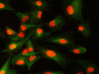 Anti-SNRNP40 Antibody