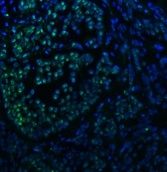 Anti-SNRNP40 Antibody