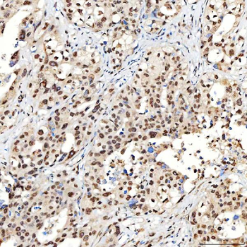 Anti-SNRNP40 Antibody