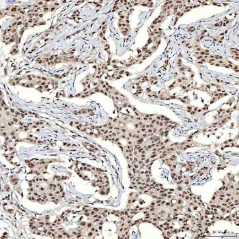 Anti-SNRNP40 Antibody