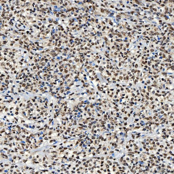 Anti-SNRNP40 Antibody