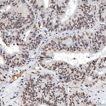 Anti-SNRNP40 Antibody