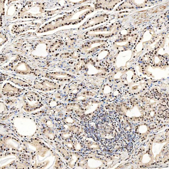 Anti-SNRNP27 Antibody