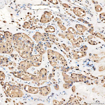 Anti-SNRNP27 Antibody
