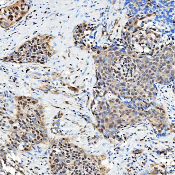 Anti-SNRNP27 Antibody