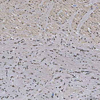 Anti-SNRNP27 Antibody
