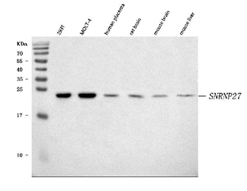 Anti-SNRNP27 Antibody
