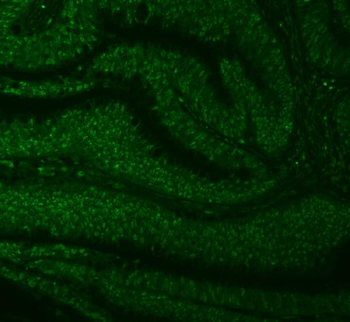 Anti-SNRNP27 Antibody