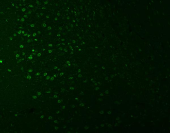 Anti-SNRNP27 Antibody