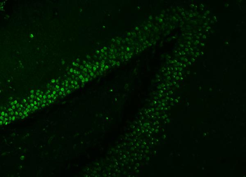 Anti-SNRNP27 Antibody
