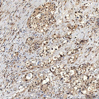 Anti-SNRNP27 Antibody